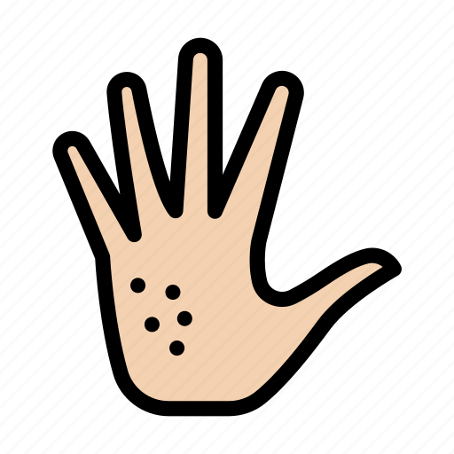 Infection, allergy, hand, skin, acne icon - Download on Iconfinder