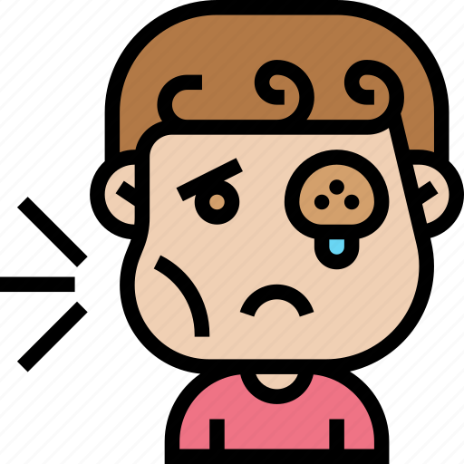 Face, swollen, inflammation, eye, infection icon - Download on Iconfinder