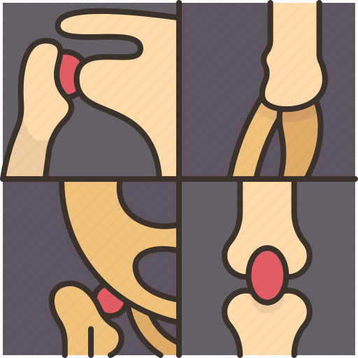 Arthritis, joints, pain, inflammation, bone icon - Download on Iconfinder