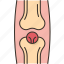 knee, joint, pain, inflammation, problem 