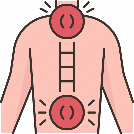 Spine, backbone, nerve, inflammation, rheumatism icon - Download on Iconfinder
