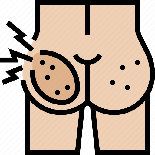 Buttock, pain, ache, muscle, condition icon - Download on Iconfinder