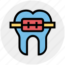 braces, dentist, medical, metal, straighten, tooth