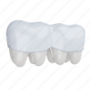 aligner, tooth, mouth guard, retainer, dental