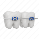 tooth, braces, dental, dentist