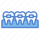 braces, dental, medical, mouth