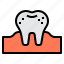 caries, dental, dentist, medical, tooth 