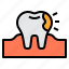 cavity, dental, dentist, medical, tooth 
