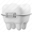 teeth, teeth braces, dental, dentist, tooth, tooth-braces, dental-care, dental-braces, protection 