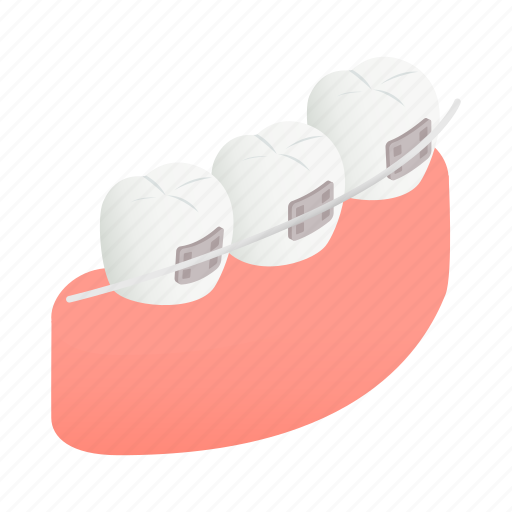 Brace, dental, female, isometric, lips, mouth, person icon - Download on Iconfinder