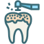 decayed tooth, dental, dentist, dentistry, oral hygiene, teeth cleaning, tooth 
