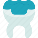 dental, overlays, restoration, oral, health
