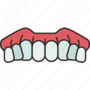 dentures, oral, prosthesis, dental, replacement