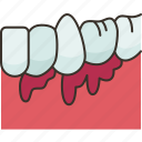 periodontal, gums, dental, health, care