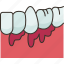 periodontal, gums, dental, health, care 