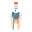 dental, dentistry, instrumentation, tooth