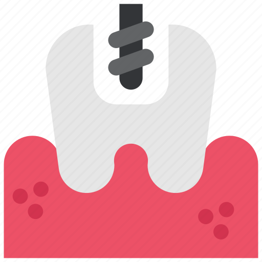 Dentist, drill, drilling machine, filling, stomatology, tooth, treatment icon - Download on Iconfinder