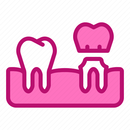 Clinic, crown, dental, dentist, molars, tooth icon - Download on Iconfinder
