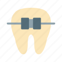 braces, dental, dentist, mouth, orthodontics, smile, teeth