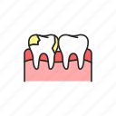 dental, caries, teeth