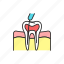 root, canal, treatment, teeth 