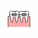 teeth, braces, orthodontics