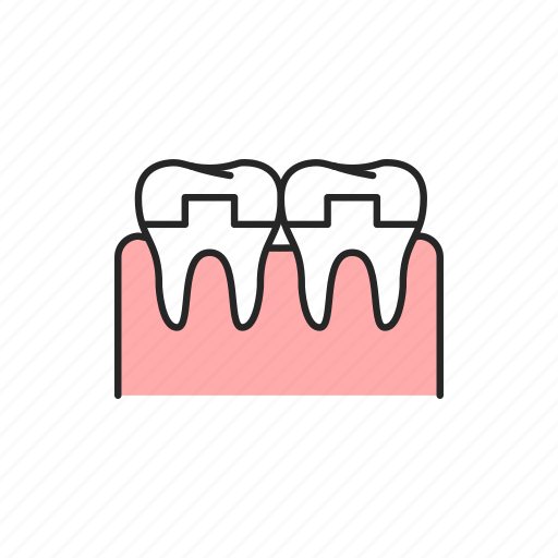 Teeth, crown, crowned icon - Download on Iconfinder