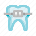 tooth, braces, dental, dental treatment, oral hygiene