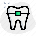 tooth, braces, dental, treatment