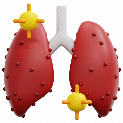 Pneumonia, lung, respiratory, virus, bacteria, organ, disease 3D illustration - Download on Iconfinder