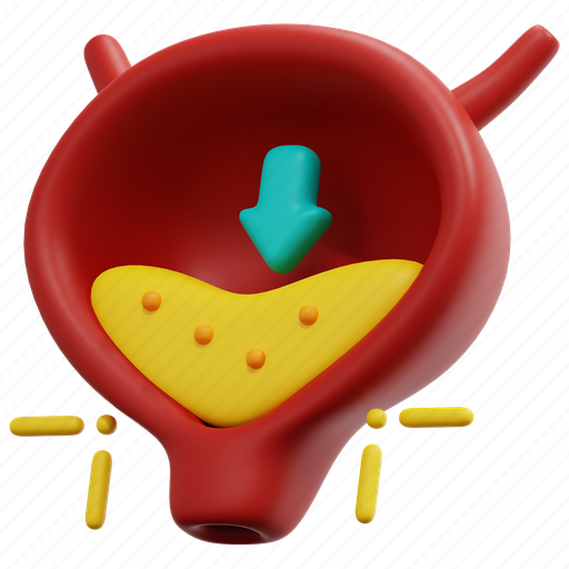 Cystitis, urinary, bladder, urethra, organ, ureter, disease 3D illustration - Download on Iconfinder