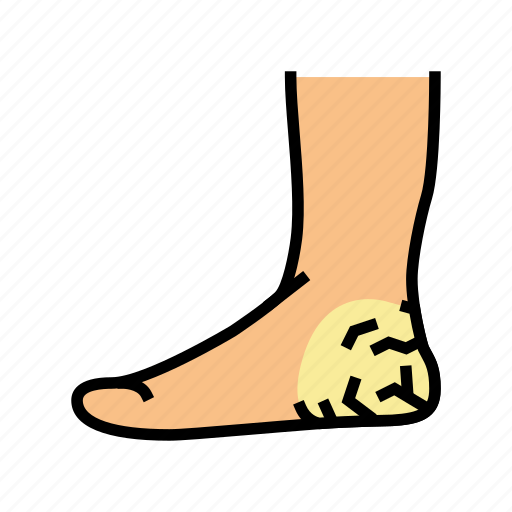 Heels, dry, skin, treatment, elbow, face icon - Download on Iconfinder