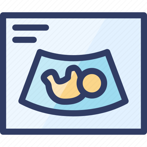 Baby, examine, health, medical, ultrasound icon - Download on Iconfinder