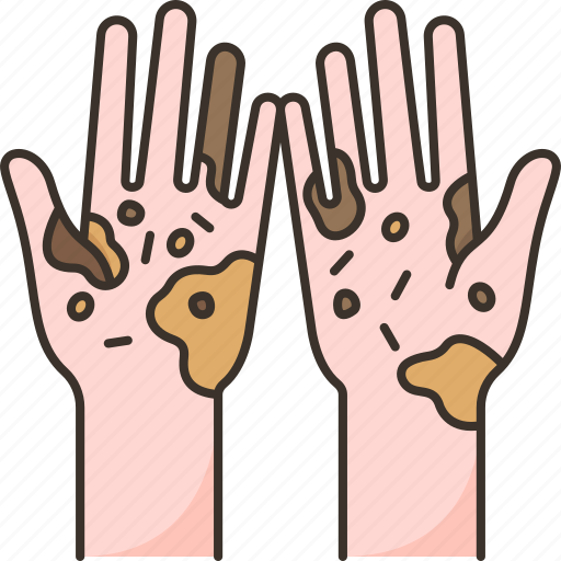Hand, dirty, hygiene, bacteria, germs icon - Download on Iconfinder