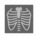 bones, chest, image, lungs, medical examination, ribs, x ray 
