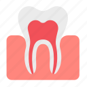 dental, dentist, dentistry, denture, gums, tooth, teeth