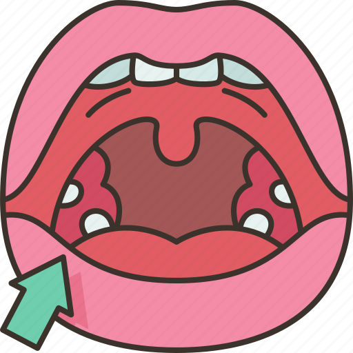 Tonsils, lymphatic, throat, human, health icon - Download on Iconfinder