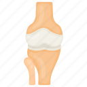 joint bone, femoral head, femur, articular cartilage, human, body part