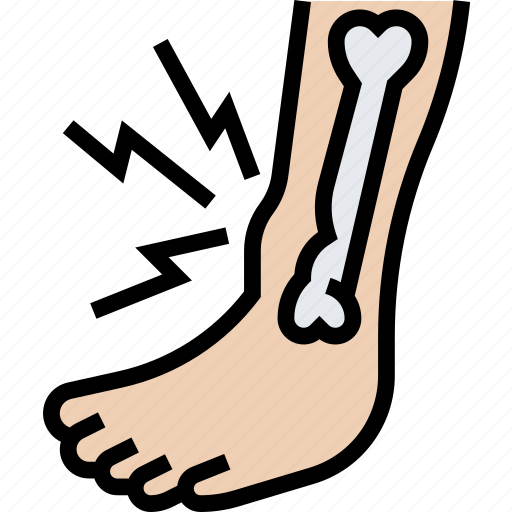 Dislocated, ankle, joint, pain, fracture icon - Download on Iconfinder