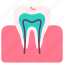 chewing, gum, human, internal, organ, teeth, tooth 
