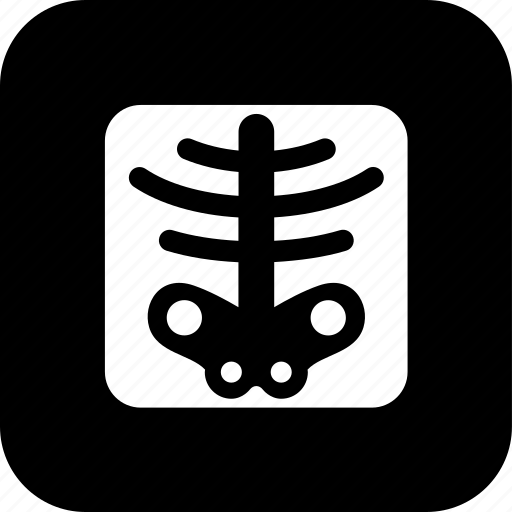 Catscan, healthcare, medecine, medical, rib cage, scan, x-ray icon - Download on Iconfinder