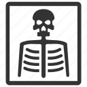 bones, medical, radiology, ray, skeleton, x ray