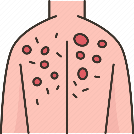 Infected, body, back, skin, lesion icon - Download on Iconfinder