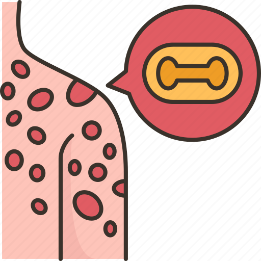 Infection, skin, lesion, monkeypox, contagious icon - Download on Iconfinder