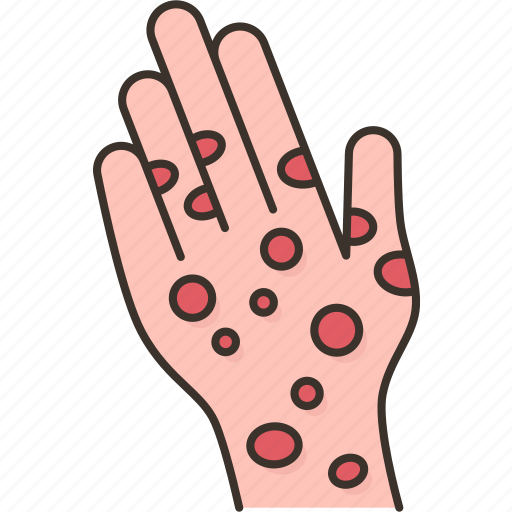 Monkeypox, rash, lesion, skin, symptom icon - Download on Iconfinder