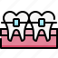 dentistry, dental care, dentist, medical, tooth, braces, orthodontic, gum, teeth 