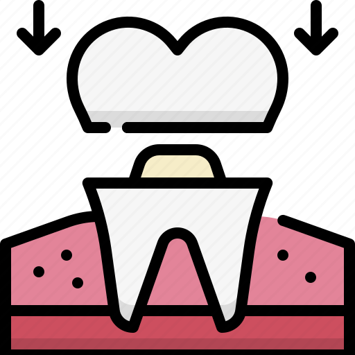 Dentistry, dental care, dentist, medical, tooth, dental crown, implant icon - Download on Iconfinder