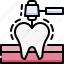 dentistry, dental care, dentist, medical, tooth, drilling, treatment, gum, cleaning 