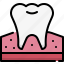 dentistry, dental care, dentist, medical, tooth, molar, gum, molar teeth 