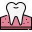 dentistry, dental care, dentist, medical, tooth, premolar, molar, gum, teeth 